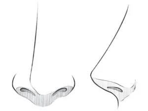 Anime nose drawing with front and side views and simple shading.